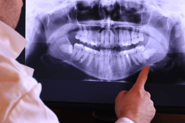 Best Emergency Broken Tooth Repair in Del City, OK